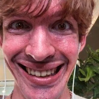 Albert's Face
